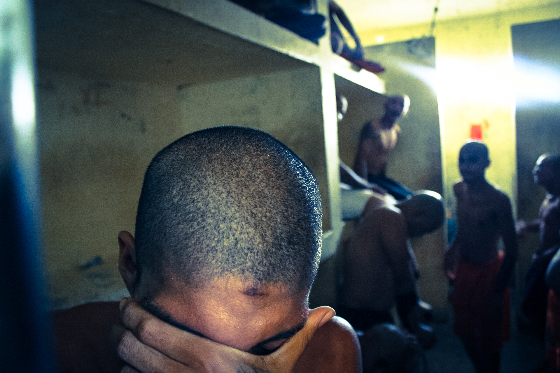 Detento na unidade Triagem do Complexo Penitenciário de Pedrinhas mostra marcas de violência causadas, segundo ele, pela polícia no momento de sua detenção. (foto: Conectas)